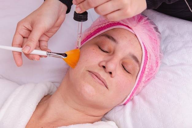 Czy po kwasach można robić peeling?