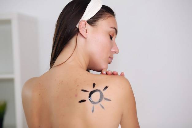 Jak wybielić plamy po słońcu domowymi sposobami?